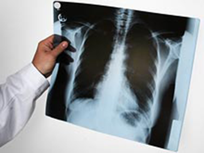 � ������ �������� ������-������� ������ �����������