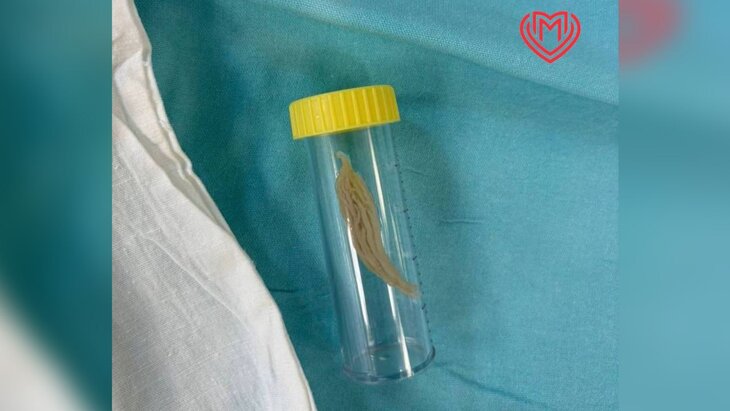 ���������� ����� �������� ����� ������ �� ������� ����������� �������