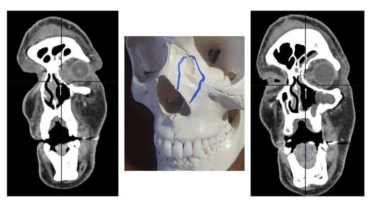 ���������� ����� ������� ��������������� ������� �������� ����� � ��������� ������� ������